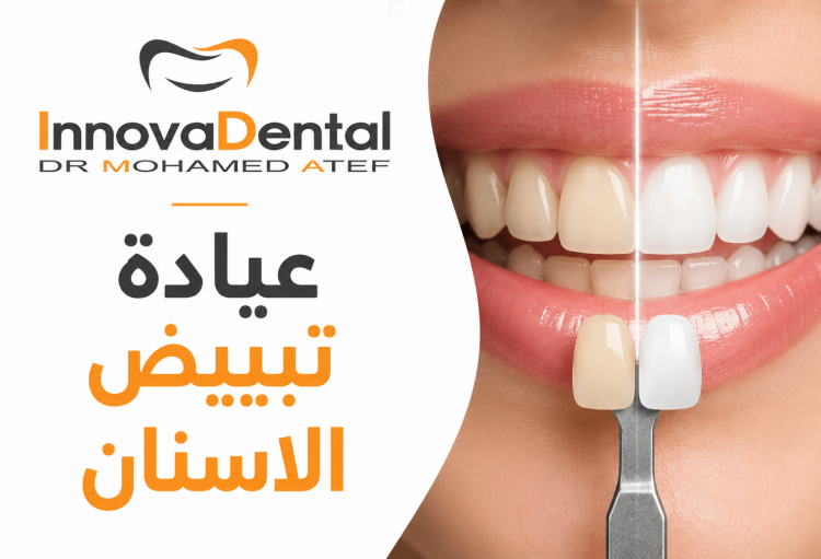Best Teeth Whitening Clinic for a Bright Smile
